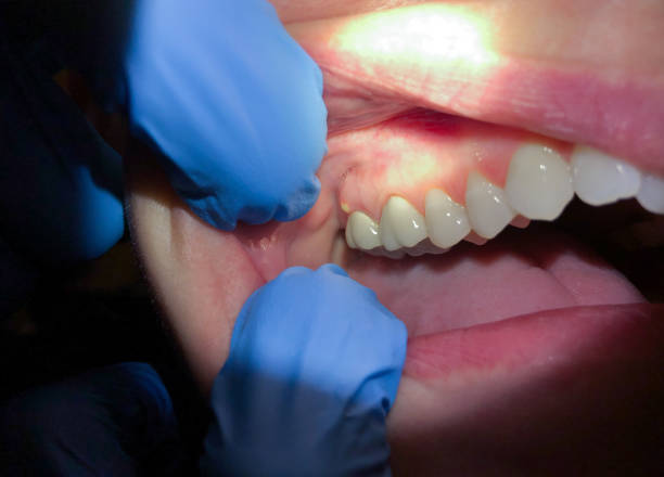 Best Emergency Gum Pain Relief  in Georgetown, DE