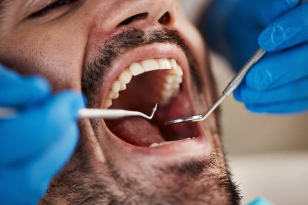 Best Urgent Tooth Repair  in Georgetown, DE